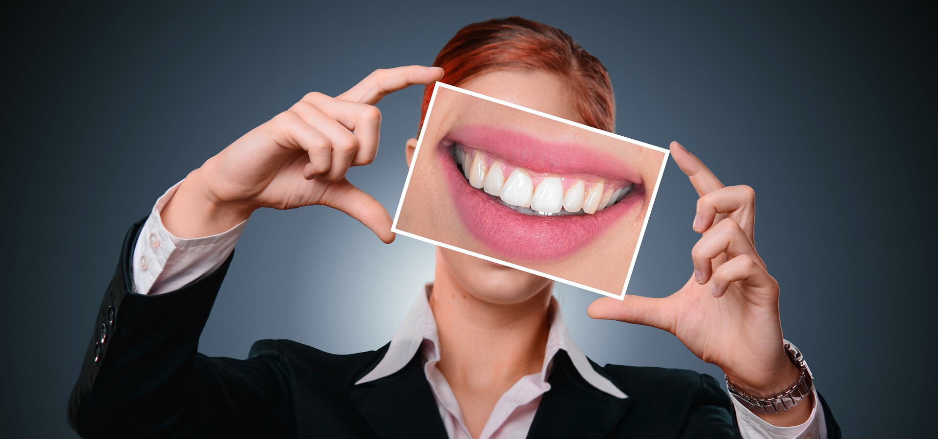 Dijital Gülüş Tasarımı Digital Dental Smile
